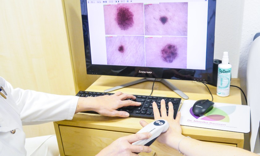 Computergestützte Hautuntersuchung in der Praxis